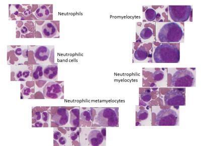 ut 112 Neutrophil Neutrophilic metamyelocytes Neutrophilic