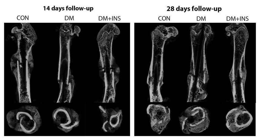 Conclusion We concluded that uncontrolled diabetes leads to dramatic changes in both trabecular and cortical bone mass and microstructure.