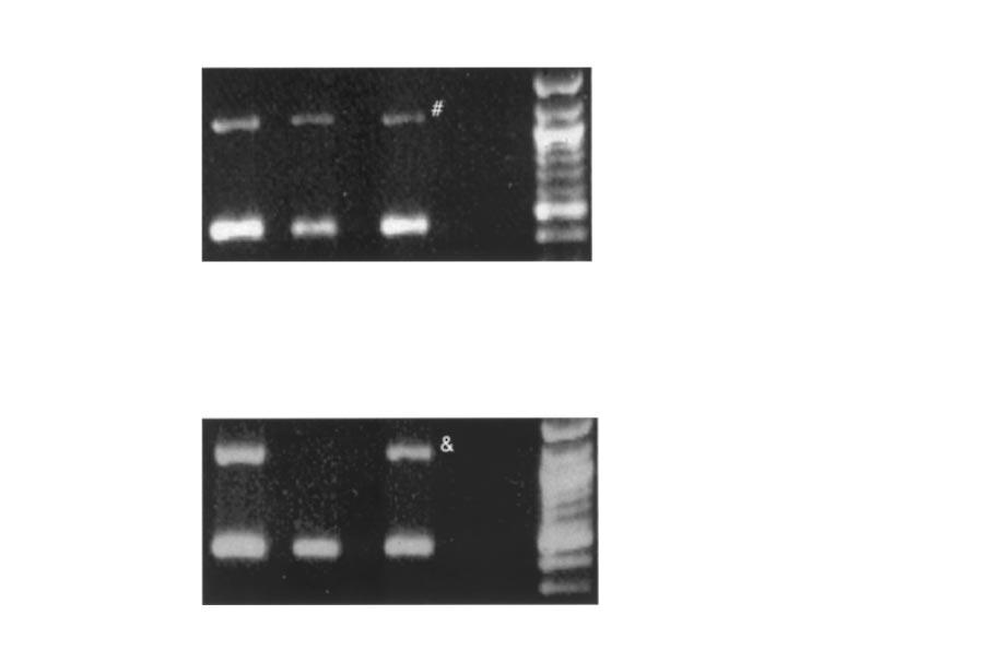 Parental origin of MECP2 mutations in RTT M Girard et al 235 Figure 2 Example of a mutation of paternal origin.