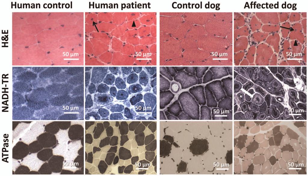 Figure 4. Histopathological comparison of muscles from human patient and IMGD dog.