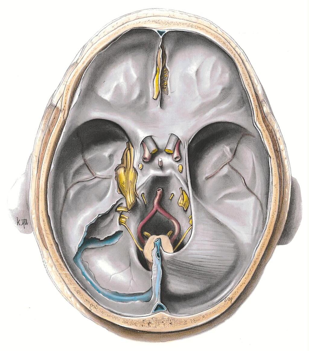 sphenoid bone. The orbital plate of the frontal bone is rather thin, and can easily be broken into and removed to gain access to the orbit and its contents.