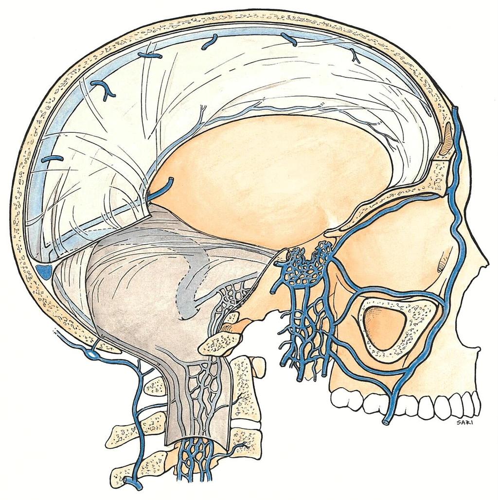 Features of the latter include the cerebellar fossae upon which the cerebellar hemispheres rest, the clivus or basilar occiput, and a prominent groove for the sigmoid sinus.