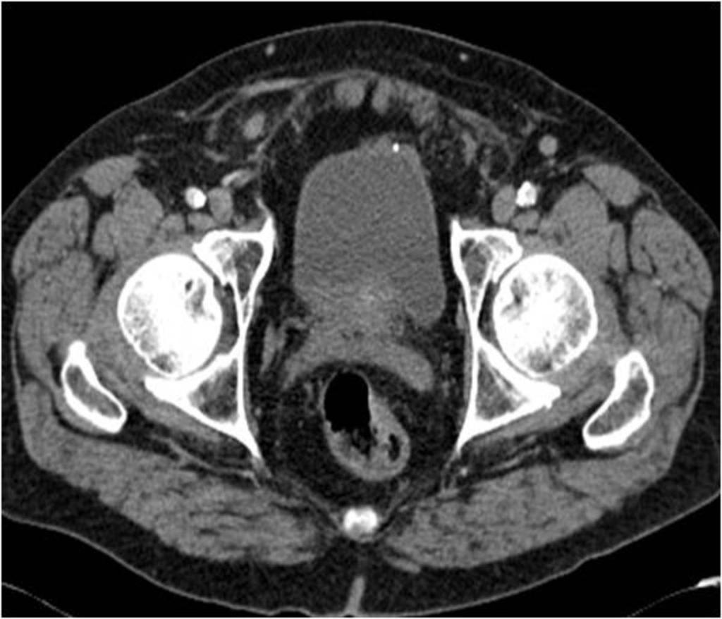 Fig. 3: Axial contrast-enhanced CT