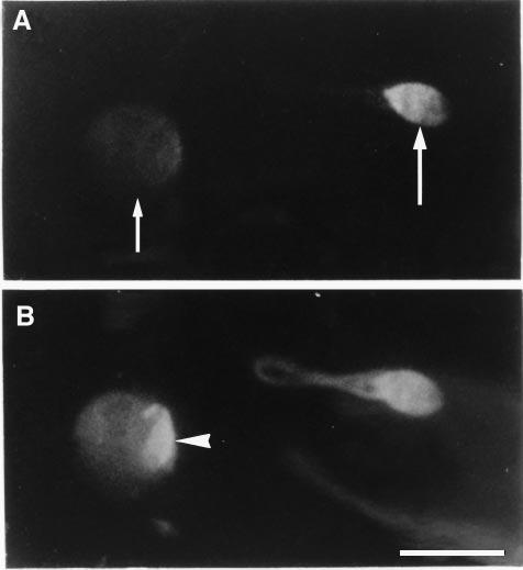 Germ cell apoptosis Figure 3. Paired fluorescence micrographs showing a round spermatid (Sa) and an elongated spermatid (Sd).