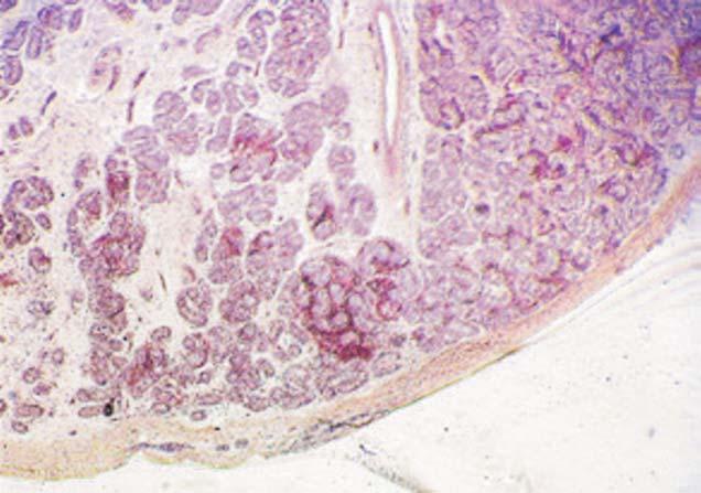 Figure 6 Peripheral portion of an ovotestis at the junction between ovary and testis showing the