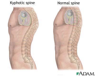 Anatomical Descriptions The spinal column which is comprised of 24 vertebrae, and although not actually separated, is for scientific purposes, separated into three sections known as the Cervical
