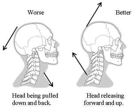 The spine naturally should have slight curvature in each area, which is depicted below image by the normal spine.