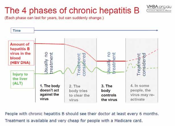 Notes This diagram shows the different phases of viral activity for a person who has lived with chronic hepatitis B since early childhood.