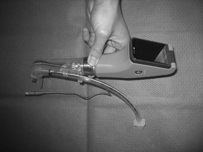 Komatsu et al. Fig 1 Airway Scope with attached Intlock blade and tracheal tube. Fig 2 Disposable Intlock blade.