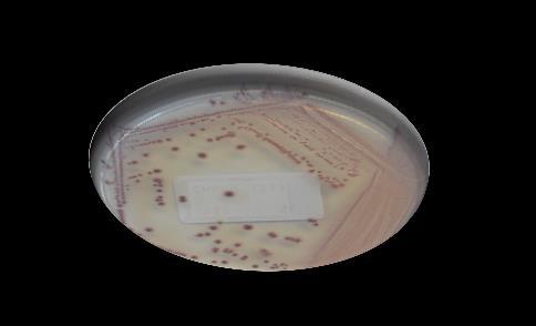 ILVO Isolation or recovery percentage (%) High selective agar medium