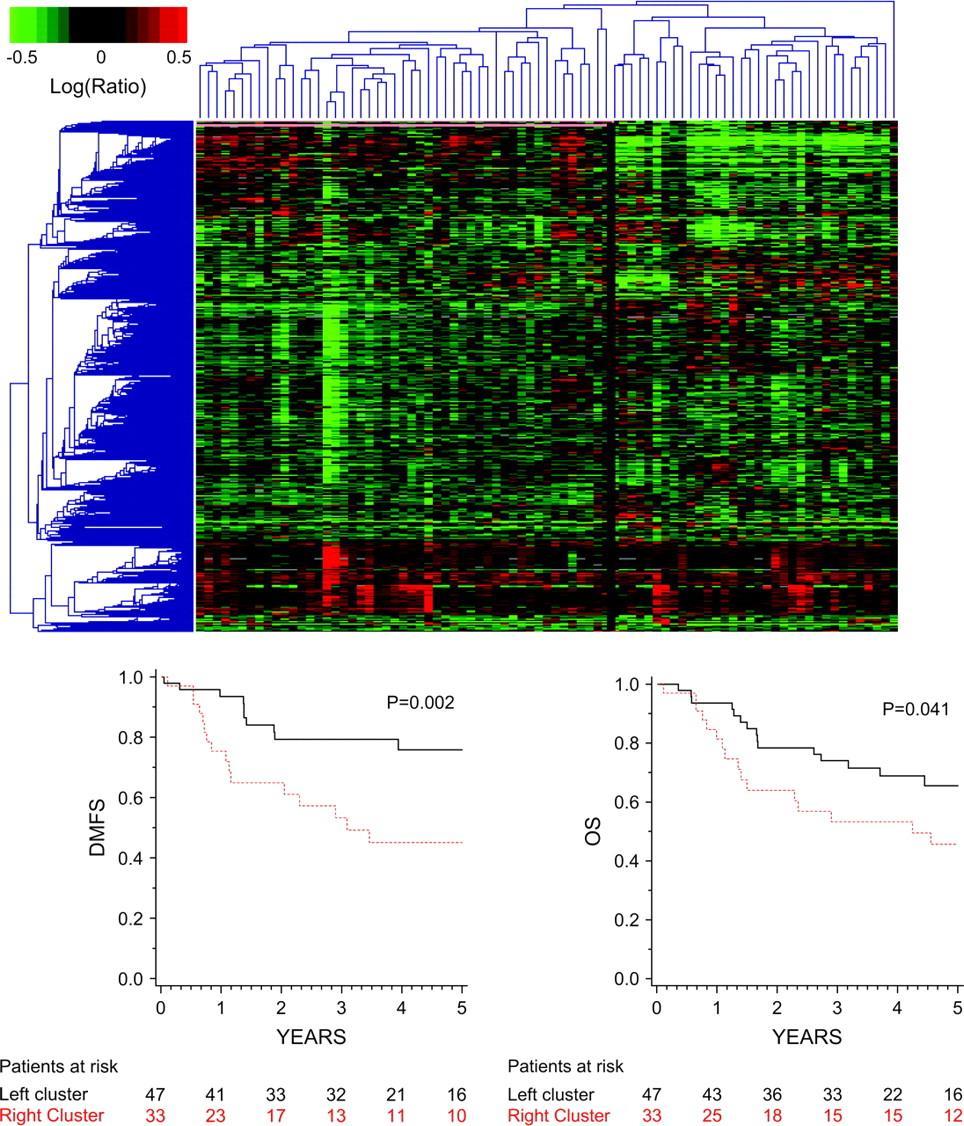 Unsupervised hierarchical clustering of 83 primary melanoma