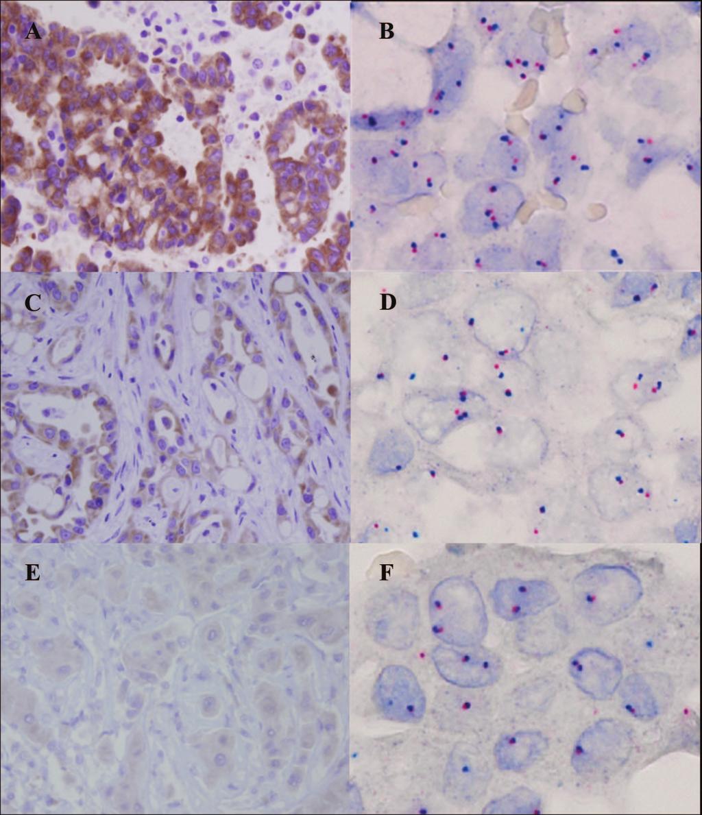 Kim et al. Journal of Thoracic Oncology Volume 6, Number 8, August 2011 FIGURE 2.