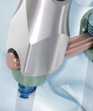 Ensure optimal saddle-to-rod contact by minimizing bends to the rod where it passes directly through the implant head. Repeat for each locking cap.