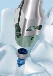 To ensure the polyaxial head is securely attached to the bone screw,