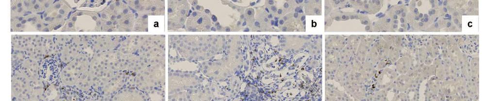 Representative pictures of glomerular macrophages in SD, untreated REN2, and Gal3i-treated REN2 rats