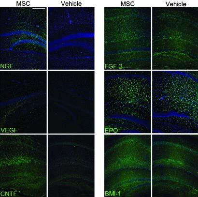MSC promote in vivo neurogenesis MSCs promote proliferation, migration, and survival of mouse
