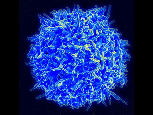T cells are immune system cells that normally fight infection Each T cell recognizes a specific target T