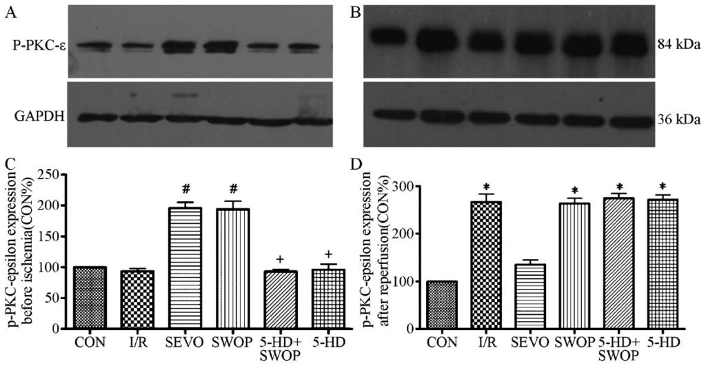 Delayed cardioprotection by sevoflurane preconditioning 533 Figure 3. p-pkc-e expression before ischemia (A,C) and 2 h after reperfusion (B,D).