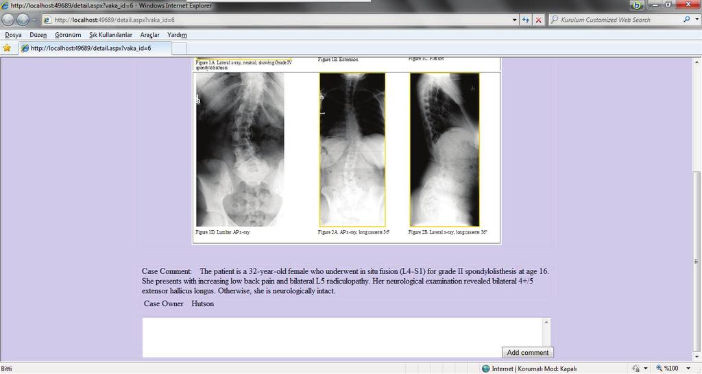 Figure 9. Detailed information about the shared case and comment-adding page. Figure 10. Vertebral video-sharing page.