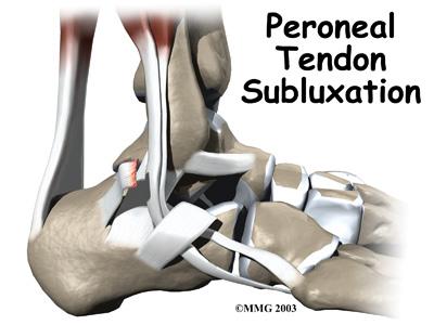The primary muscles supporting the lateral (outer) part of the ankle are the peroneals.