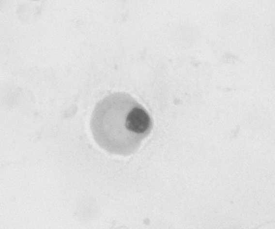 1) spermatogenic and nonspermatogenic round cells (Fig. 2).