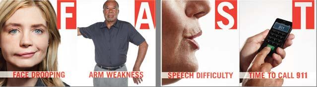 Stroke Warning Signs and Symptoms F.A.S.T. is an easy way to remember the sudden signs and symptoms of a stroke. When you can spot the signs, you'll know quickly that you need to call 9-1-1 for help.