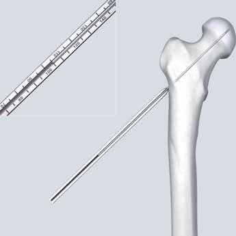 Implantation 3 Determine length of DHS Blade Instrument 338.