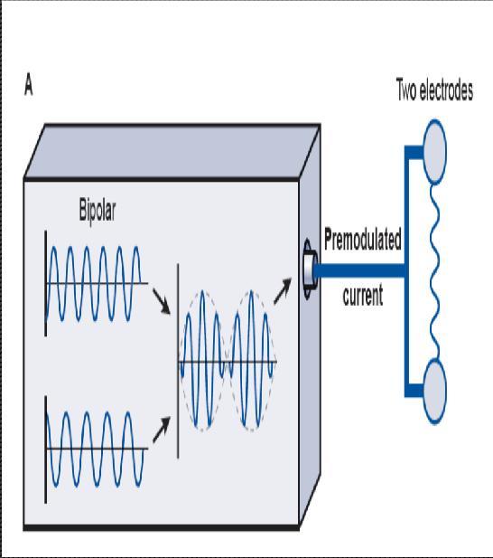 Pre - Modulated IFC 2-poles IFC (Bipolar)/1channel/2electordes Production Interference of two medium frequency sinusoidal current circuit 1 ; C1=3000Hz), with another Circuit ;C2=3050Hz), to