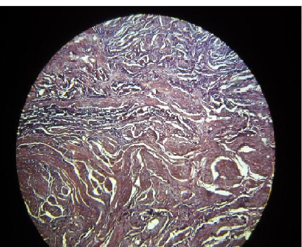 only longitudinal arranged striations muscle tissue stained