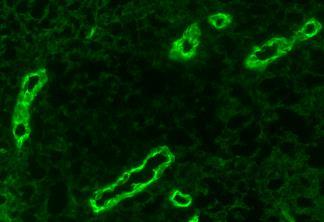 Mucosal Addressin Cell Adhesion Molecule-1 (MAdCAM-1) MAdCAM-1 staining of PP HEV