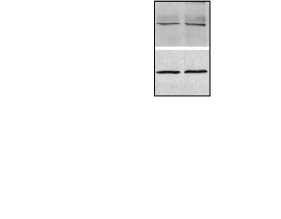 of RhoA Activity during Mitosis A RhoA-GTP ECT-2 GAP GEF? RhoA-GDP Single furrow RhoA-GTP ECT-2 GAP GEF? RhoA-GDP No furrow RhoA-GTP ECT-2 GAP GEF?