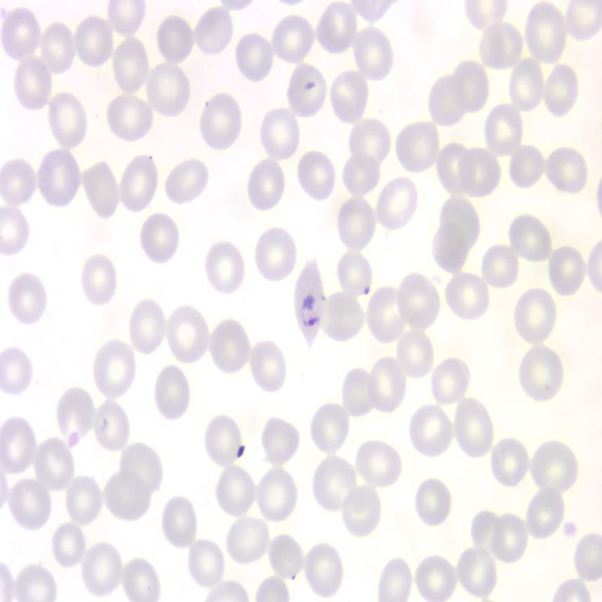 Malaria- P. ovale May appear very similar to P.