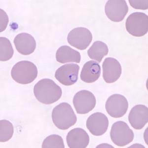 Malaria- P. knowlesi Image from CDC Morphologically similar to both P. falciparum and P.
