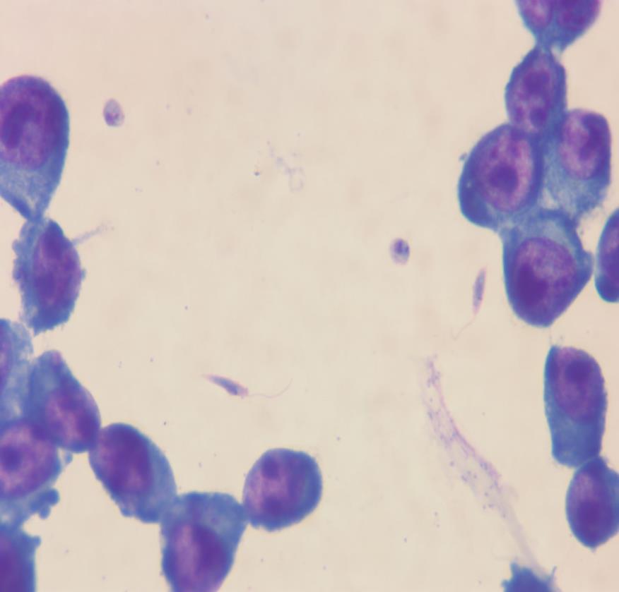 Leishmania Morphology Normally only seen in tissue smears Amastigote stage seen almost exclusively (downward-pointing arrows to the left) Rare, flagellated promastigote