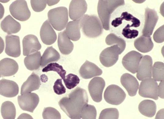 Ehrlichia/ Anaplasma Not officially a blood parasite May come across these pathogens in blood smear examinations