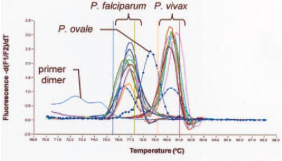 Malaria PCR- Melt Curve Analysis WISCONSIN STATE