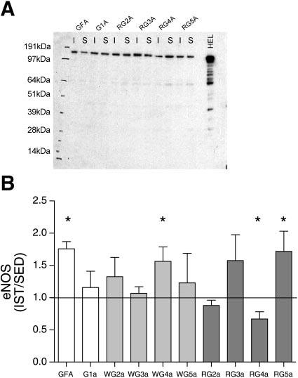 238 ENDOTHELIUM AND INTERVAL SPRINT TRAINING Fig. 3. Effects of IST on endothelial nitric oxide synthase (enos) protein content of gastrocnemius muscle arteries.