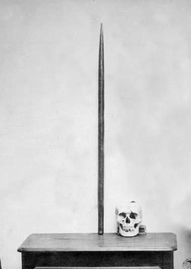 Phineas Gage: The Man with a