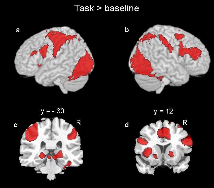 FIGURE 6.3. COMMONLY ACTIVATED REGIONS FROM BOTH TASKS VERSUS BASELINE. a, b: Whole brain 3D rendering with cortical activation overlay. a. Left hemisphere. b. Right hemisphere.