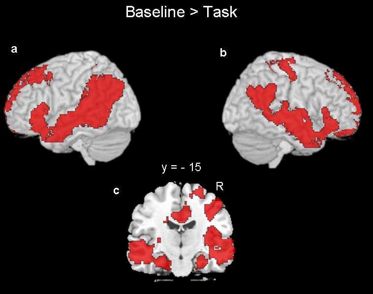 Brain region Size Max Z x y z Whole brain cluster corrected (p <.05) Posterior cingulate (BA 23) 4494 5.49-10 -42 40 L Angular gyrus (BA 39) 2008 5.79-56 -62 22 R Supramarginal (BA 40) 1880 5.