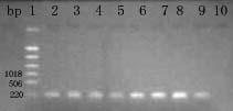 Yang et al. 4521 Figure 1. PCR amplification of rpob gene. Lane 1-6: sputum with MDR-TB; Lane 7 pan-susceptible strain; Lane 8: pandrug-resistant TB; Lane 9: H37Rv standard M.