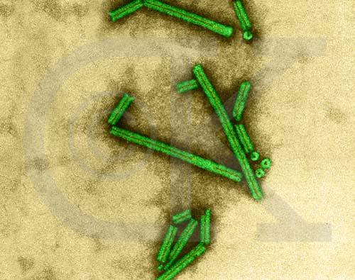 First virus discovered Tobacco Mosaic Virus by Martinus Beijerinck 1898 Founder of Virology even