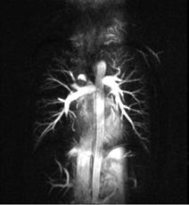 angiogram in a 27-year-old male volunteer by