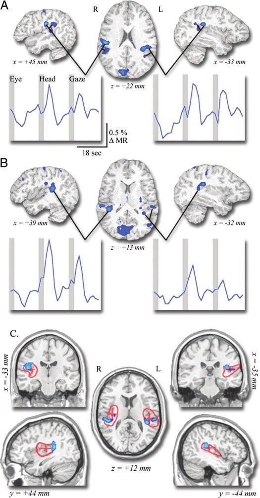 NEURAL BASIS OF HEAD MOVEMENTS STUDIED WITH FMRI 2523 the SC, possibly corresponding to other nuclei important in the control of eye and head movements, such as the pontine reticular formation.