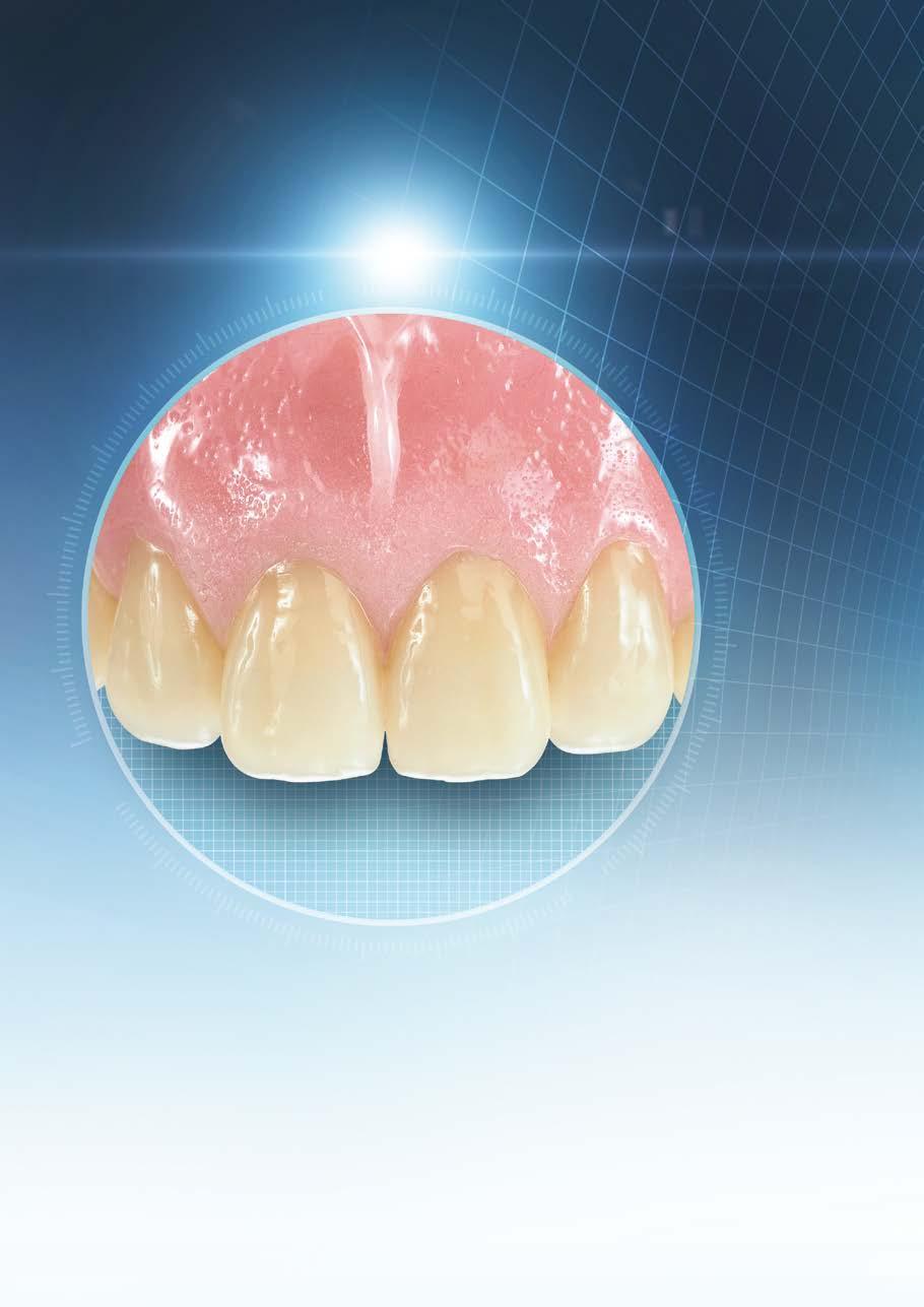 DESIGN BASED ON NATURAL TEETH VITAPAN EXCELL: The denture