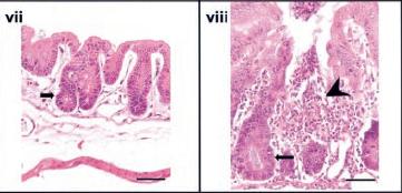 Inflammatory Bowel Disease In PI3K p110dd910a Mutant Mice WT/WT