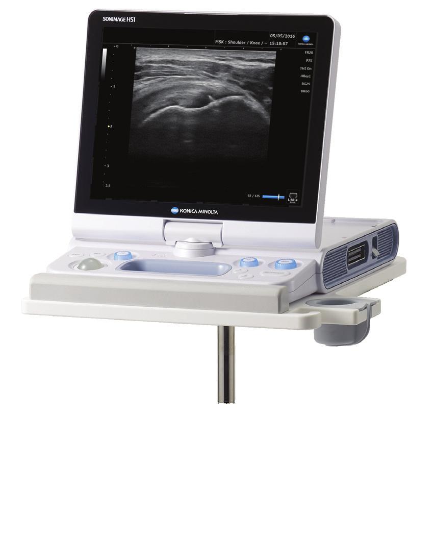 SONIMAGE HS1 Compact Ultrasound System with ultrasound.