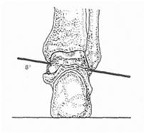 closed kinetic chain function following ankle fracture Biokinesiology of the Ankle Complex