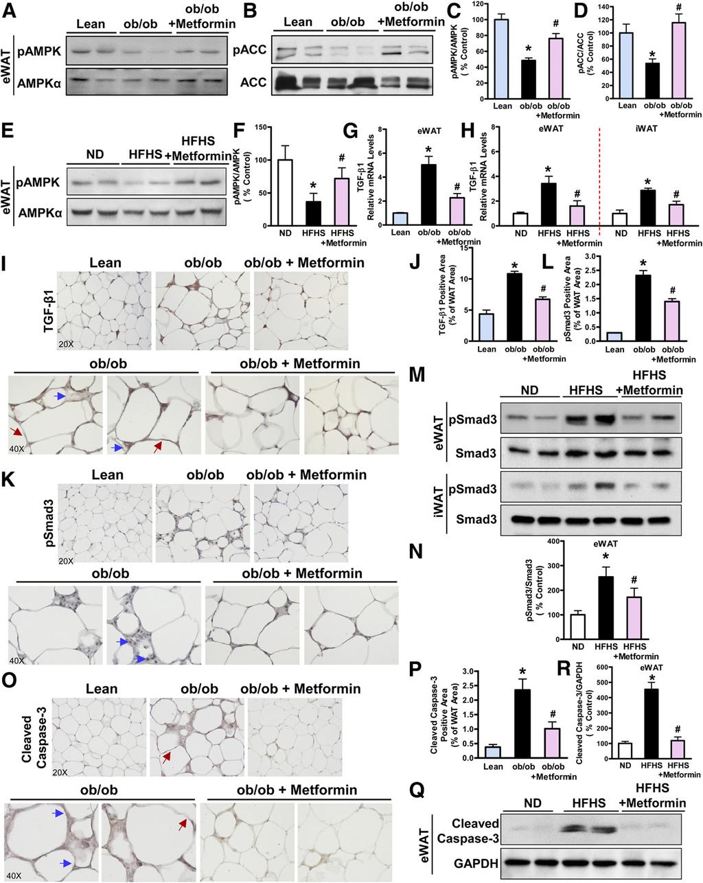 2300 Antifibrotic Role of AMPK in Adipose Tissue Diabetes Volume 65, August 2016 Figure 4 Metformin stimulates AMPK activity and inhibits TGF-b1/Smad3 signaling in WAT of obese mice.