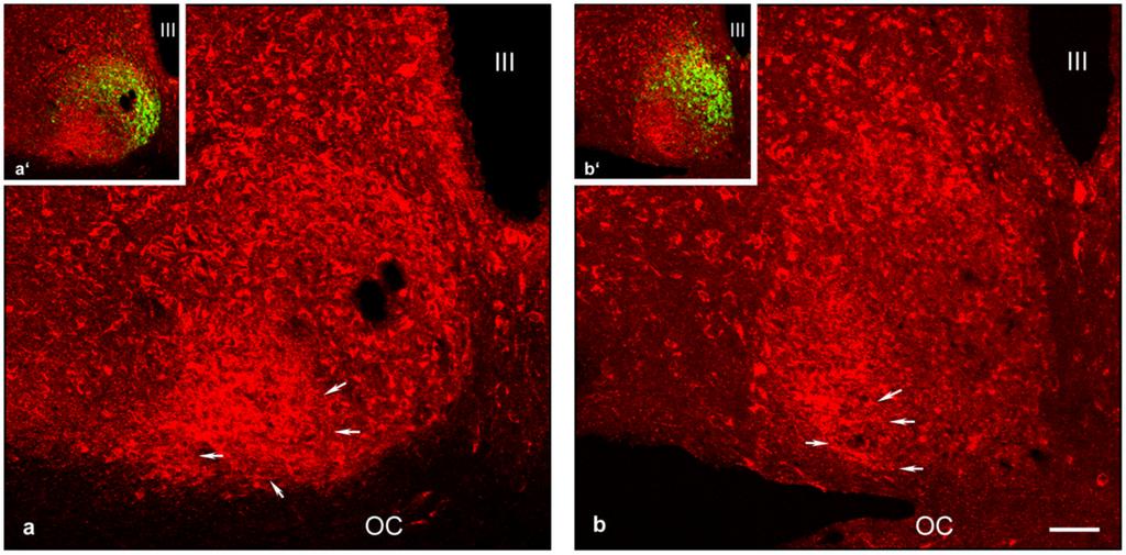 Belenky et al. Page 24 Fig. 6. Confocal images demonstrating expression of NKCC1 in the mid rostrocaudal region of the SCN from rats sacrificed at ZT5 (panel a) and at ZT17 (panel b).